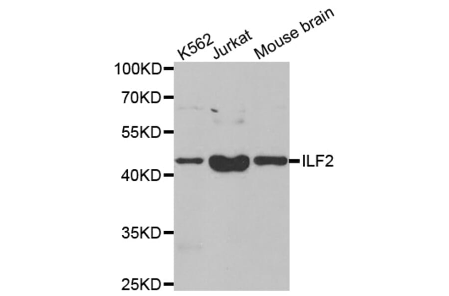 Anti-ILF2 Antibody from Bioworld Technology (BS8077) - Antibodies.com