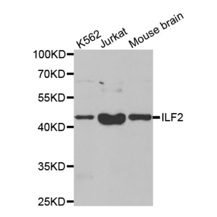 Anti-ILF2 Antibody from Bioworld Technology (BS8077) - Antibodies.com