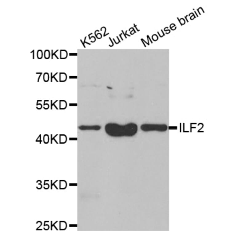 Anti-ILF2 Antibody from Bioworld Technology (BS8077) - Antibodies.com
