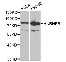 Anti-HNRNPR Antibody from Bioworld Technology (BS8078) - Antibodies.com