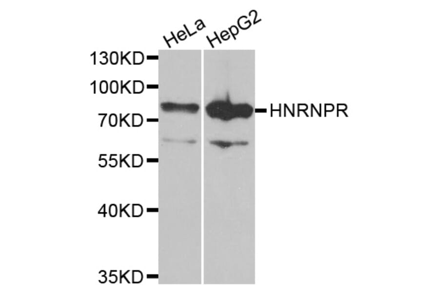 Anti-HNRNPR Antibody from Bioworld Technology (BS8078) - Antibodies.com