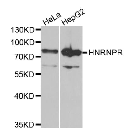 Anti-HNRNPR Antibody from Bioworld Technology (BS8078) - Antibodies.com