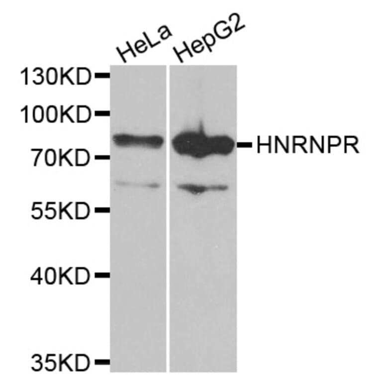 Anti-HNRNPR Antibody from Bioworld Technology (BS8078) - Antibodies.com