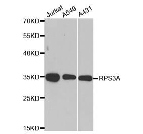 Anti-RPS3A Antibody from Bioworld Technology (BS8079) - Antibodies.com