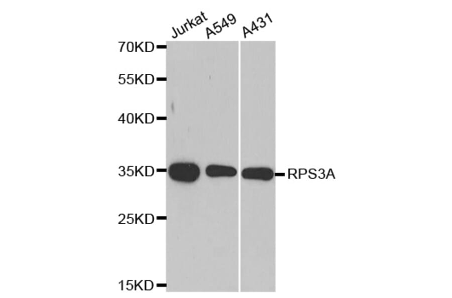 Anti-RPS3A Antibody from Bioworld Technology (BS8079) - Antibodies.com