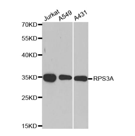 Anti-RPS3A Antibody from Bioworld Technology (BS8079) - Antibodies.com