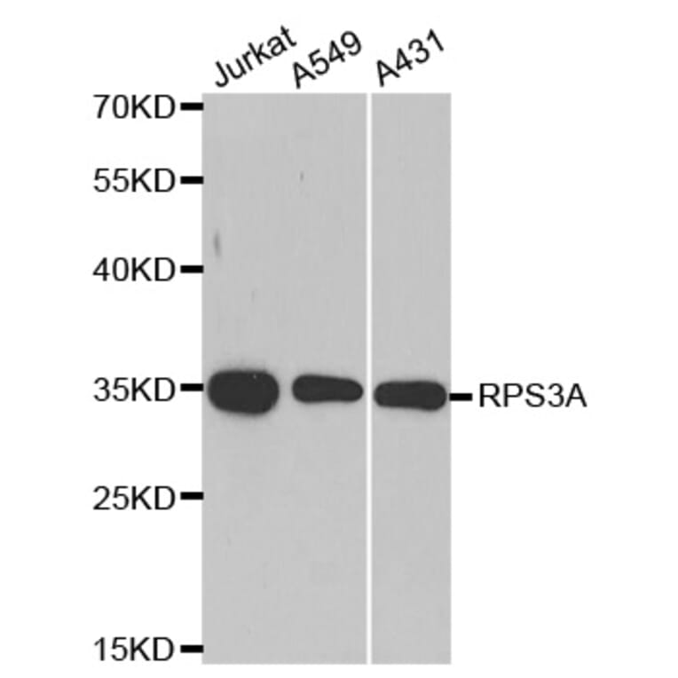 Anti-RPS3A Antibody from Bioworld Technology (BS8079) - Antibodies.com