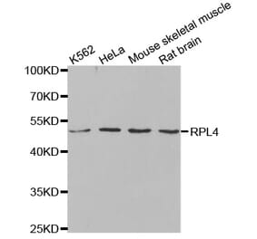 Anti-RPL4 Antibody from Bioworld Technology (BS8080) - Antibodies.com