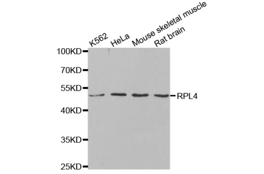 Anti-RPL4 Antibody from Bioworld Technology (BS8080) - Antibodies.com