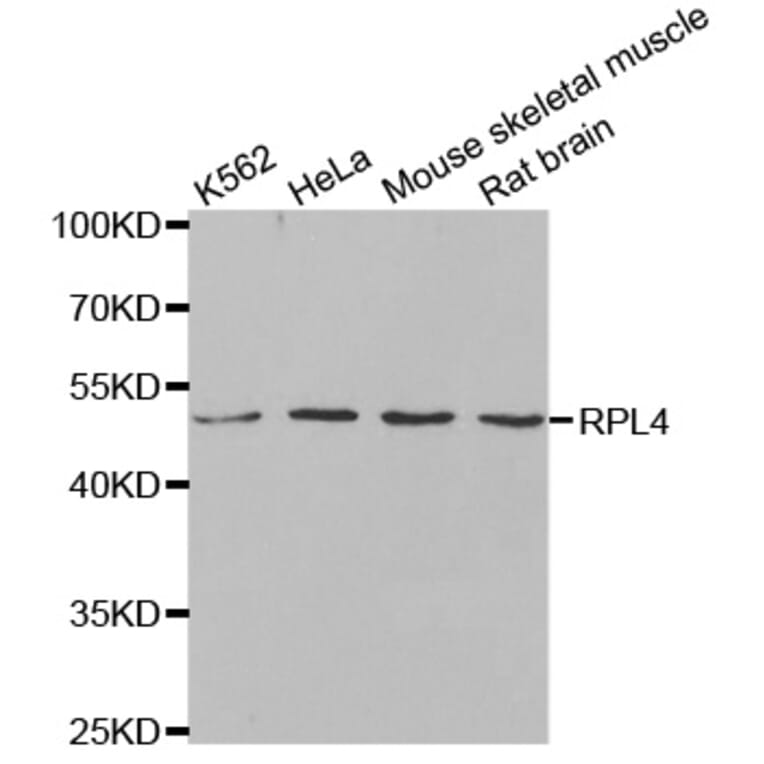 Anti-RPL4 Antibody from Bioworld Technology (BS8080) - Antibodies.com