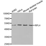 Anti-RPL4 Antibody from Bioworld Technology (BS8080) - Antibodies.com