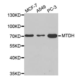 Anti-MTDH Antibody from Bioworld Technology (BS8081) - Antibodies.com