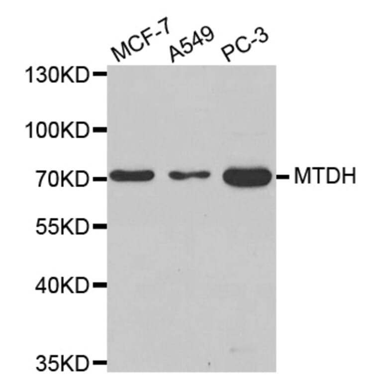 Anti-MTDH Antibody from Bioworld Technology (BS8081) - Antibodies.com