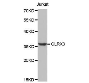 Anti-GLRX3 Antibody from Bioworld Technology (BS8084) - Antibodies.com