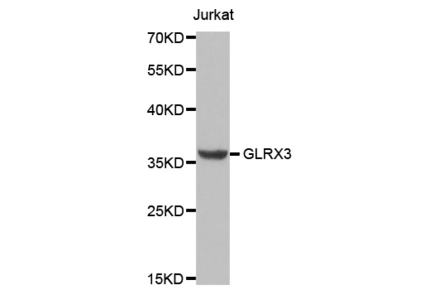 Anti-GLRX3 Antibody from Bioworld Technology (BS8084) - Antibodies.com