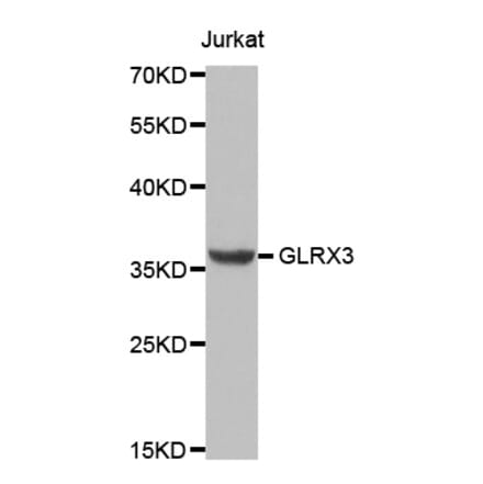 Anti-GLRX3 Antibody from Bioworld Technology (BS8084) - Antibodies.com