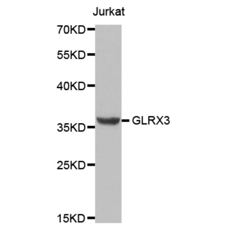 Anti-GLRX3 Antibody from Bioworld Technology (BS8084) - Antibodies.com