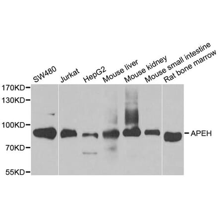 Anti-APEH Antibody from Bioworld Technology (BS8085) - Antibodies.com