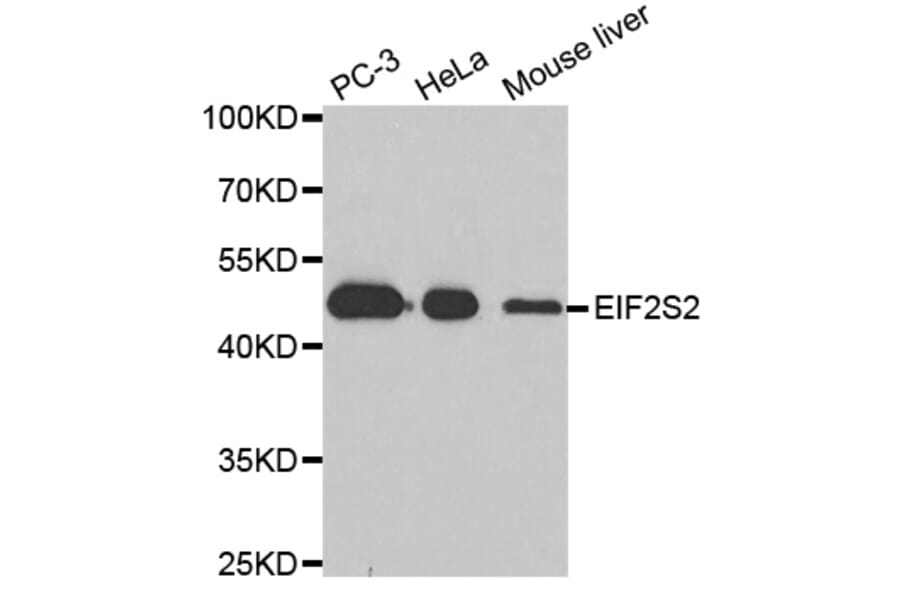 Anti-EIF2S2 Antibody from Bioworld Technology (BS8086) - Antibodies.com