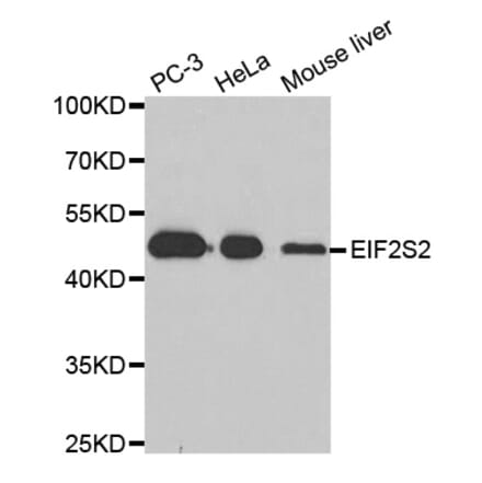 Anti-EIF2S2 Antibody from Bioworld Technology (BS8086) - Antibodies.com