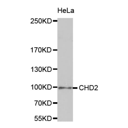 Anti-CHD2 Antibody from Bioworld Technology (BS8087) - Antibodies.com