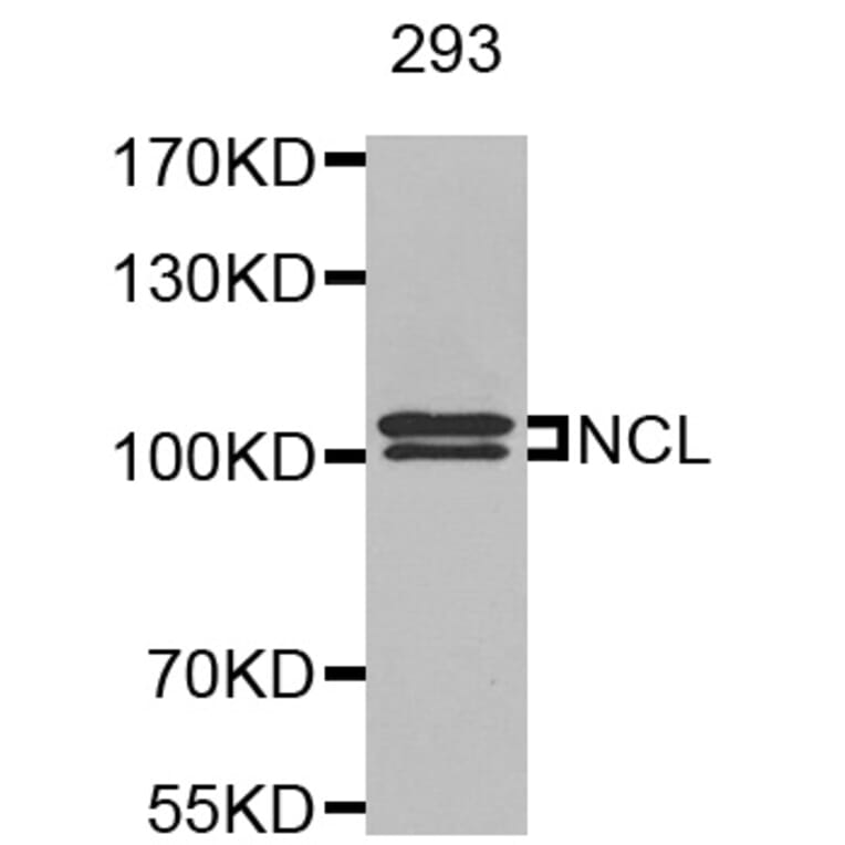 Anti-NCL Antibody from Bioworld Technology (BS8090) - Antibodies.com