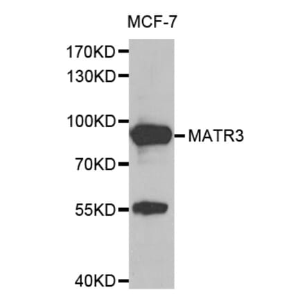 Anti-MATR3 Antibody from Bioworld Technology (BS8091) - Antibodies.com