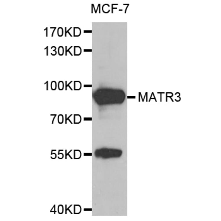 Anti-MATR3 Antibody from Bioworld Technology (BS8091) - Antibodies.com