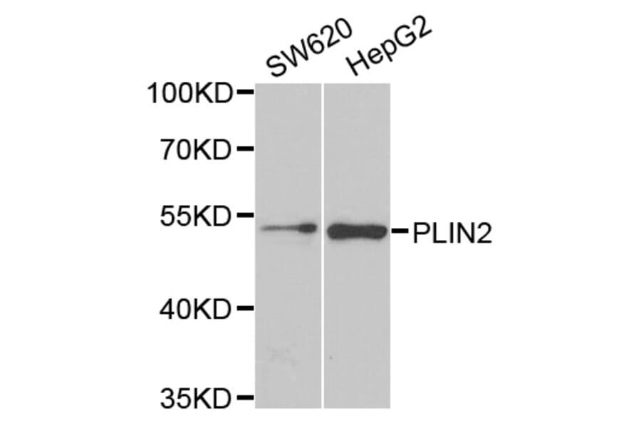 Anti-ADFP Antibody from Bioworld Technology (BS8094) - Antibodies.com