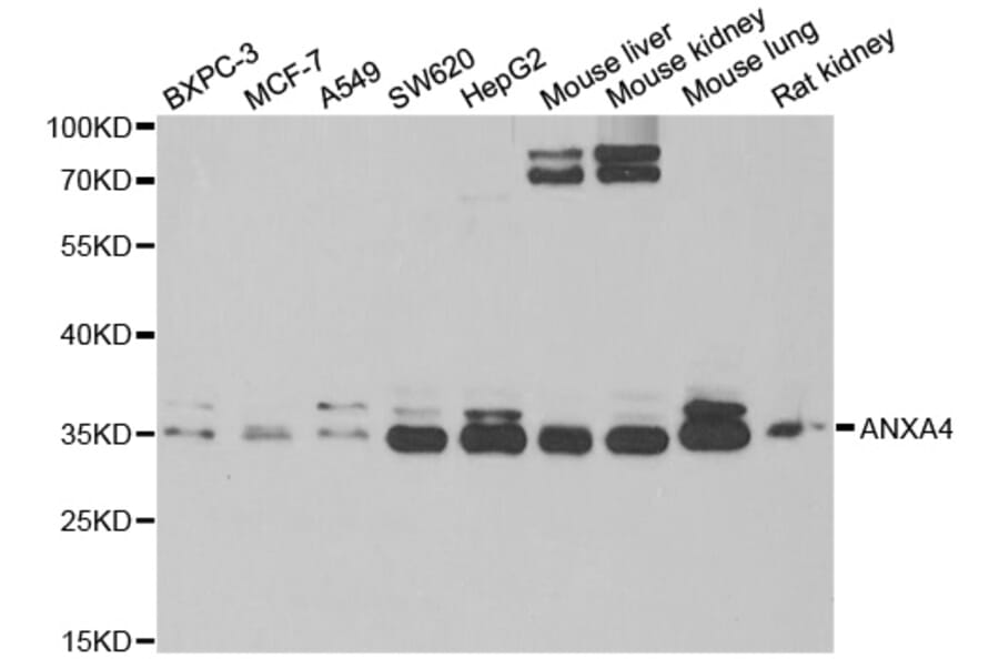 Anti-ANXA4 Antibody from Bioworld Technology (BS8098) - Antibodies.com