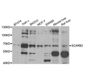 Anti-SCARB2 Antibody from Bioworld Technology (BS8102) - Antibodies.com