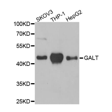 Anti-GALT Antibody from Bioworld Technology (BS8105) - Antibodies.com