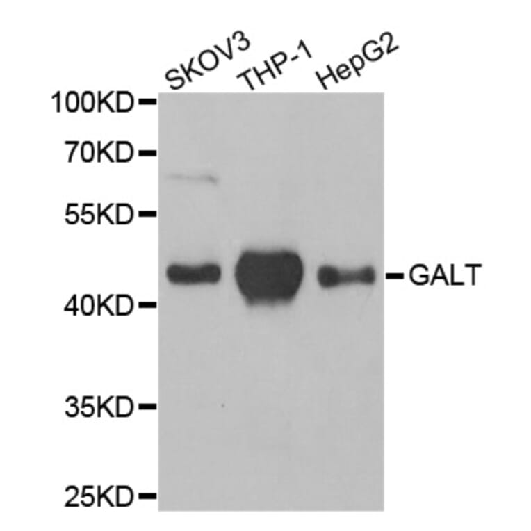 Anti-GALT Antibody from Bioworld Technology (BS8105) - Antibodies.com