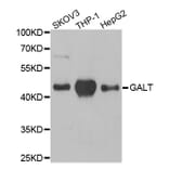 Anti-GALT Antibody from Bioworld Technology (BS8105) - Antibodies.com