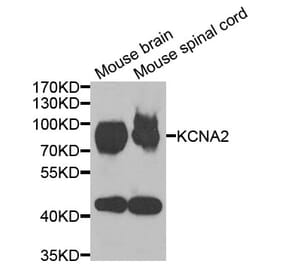 Anti-KCNA2 Antibody from Bioworld Technology (BS8107) - Antibodies.com