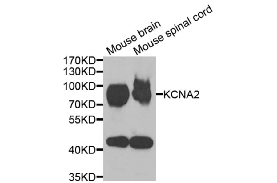 Anti-KCNA2 Antibody from Bioworld Technology (BS8107) - Antibodies.com