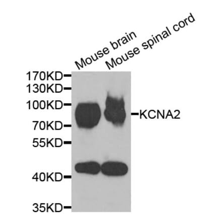 Anti-KCNA2 Antibody from Bioworld Technology (BS8107) - Antibodies.com