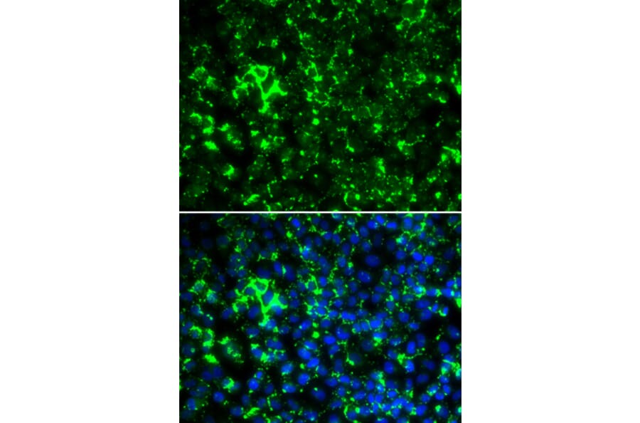 Anti-KCNA2 Antibody from Bioworld Technology (BS8107) - Antibodies.com