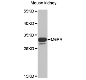 Anti-M6PR Antibody from Bioworld Technology (BS8108) - Antibodies.com