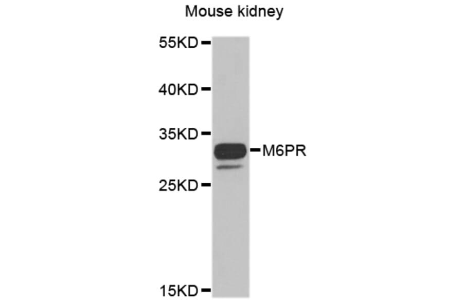Anti-M6PR Antibody from Bioworld Technology (BS8108) - Antibodies.com