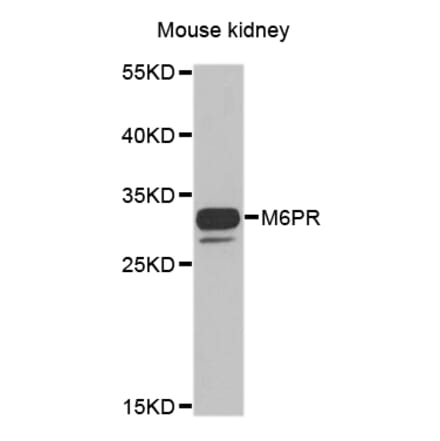 Anti-M6PR Antibody from Bioworld Technology (BS8108) - Antibodies.com