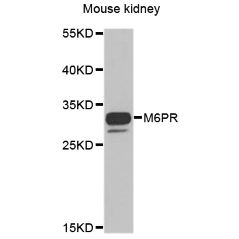 Anti-M6PR Antibody from Bioworld Technology (BS8108) - Antibodies.com