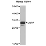 Anti-M6PR Antibody from Bioworld Technology (BS8108) - Antibodies.com