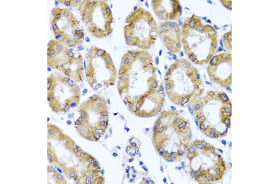 Anti-M6PR Antibody from Bioworld Technology (BS8108) - Antibodies.com