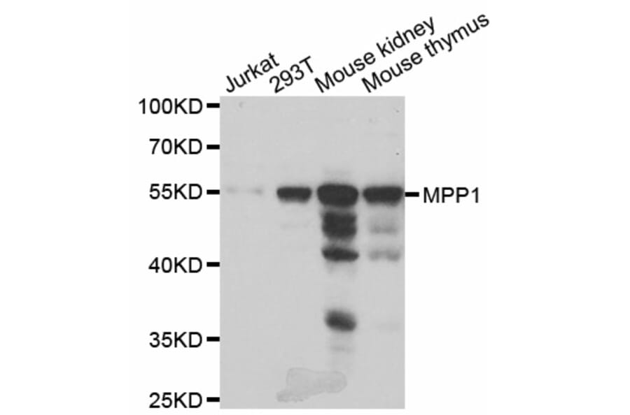 Anti-MPP1 Antibody from Bioworld Technology (BS8110) - Antibodies.com