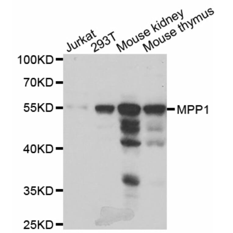 Anti-MPP1 Antibody from Bioworld Technology (BS8110) - Antibodies.com