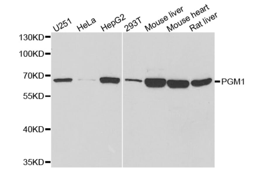 Anti-PGM1 Antibody from Bioworld Technology (BS8114) - Antibodies.com
