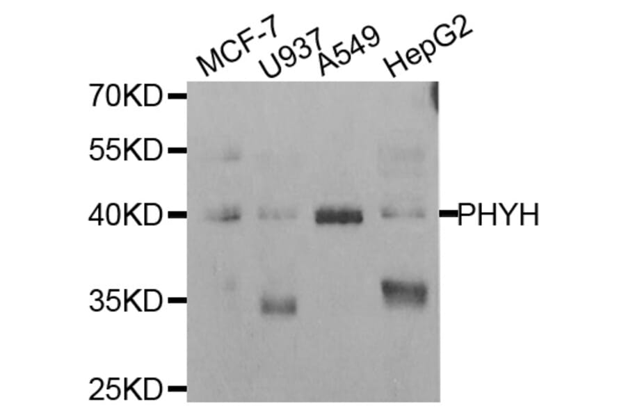 Anti-PHYH Antibody from Bioworld Technology (BS8115) - Antibodies.com