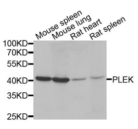 Anti-PLEK Antibody from Bioworld Technology (BS8116) - Antibodies.com