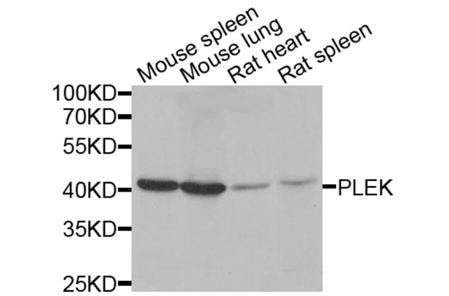 Anti-PLEK Antibody from Bioworld Technology (BS8116) - Antibodies.com